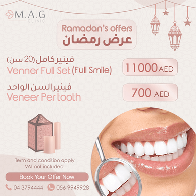 Ramadan Offer Veneer Full Set 11000 Single Tooth 700 AED