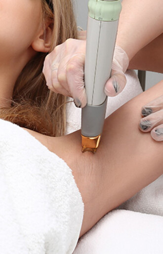 Laser Hair Removal