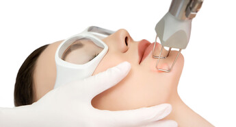 CO2 Fractional Laser