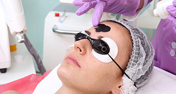 Carbon Laser Treatment