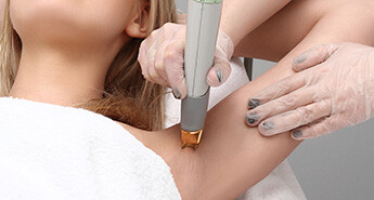 Laser Hair Removal