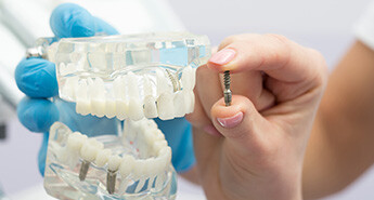 Dental Implant