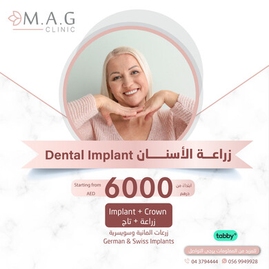 Best Dental Implant Quality and Price